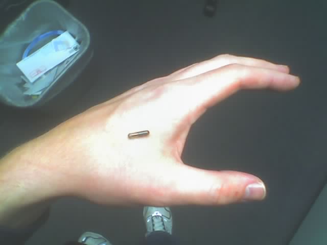 Microchip under skin